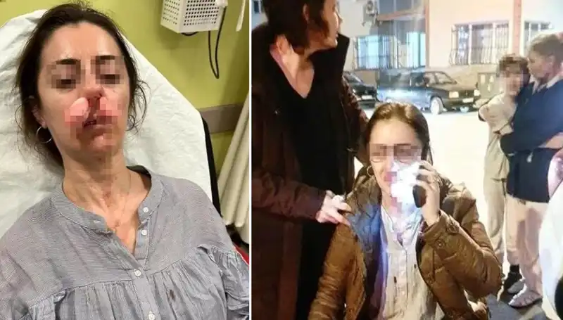 Eşinin Sevgilisiyle Kaza Yapınca Otomobil Kapısını Silah Olarak Kullandı!