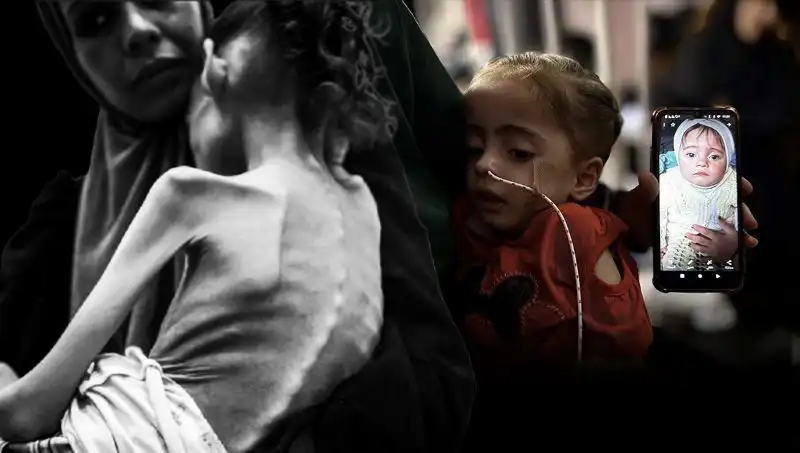 Küçük Meryem’in Açlıkla Mücadelesi: 25 Kilodan 10 Kiloya Düşüşün Ardındaki Duygular