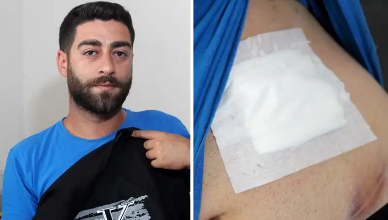 Karnında Ağrı Hissetti, Röntgendeki Şok Gerçek Herkesi Şaşırttı