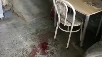 Sandalyeden Düşerek Ağır Yaralanan Bir Adamın Psikolojik Durumu