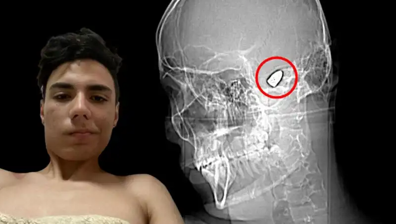 Kafasında Patlamaya Hazır Bomba ile Yaşayanların Acı Gerçekleri